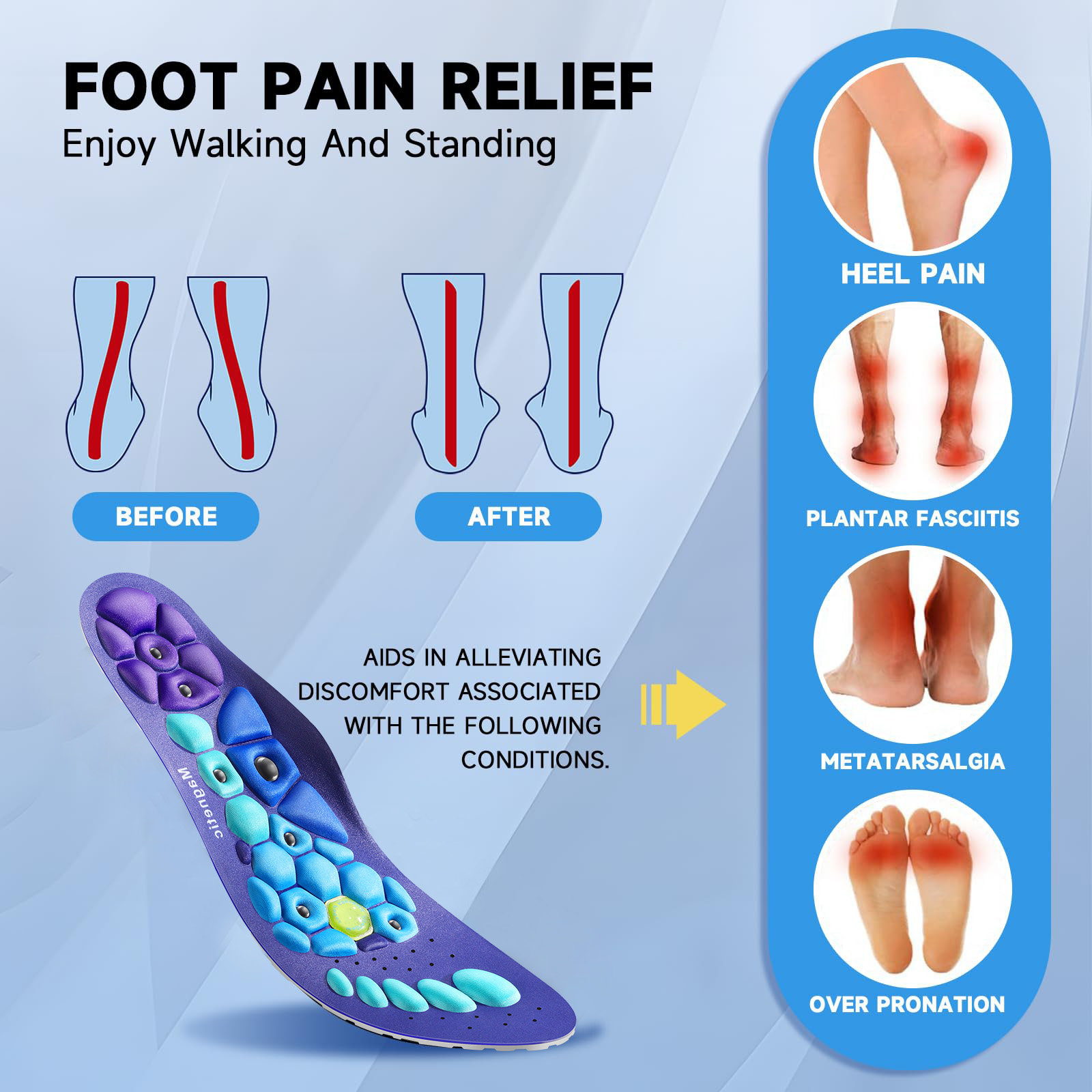Acupressure Insoles for Men and Women - Orthopedic Acupoint Massage Insoles with Magnetic Technology, Shock Absorption, Non-Slip, Feet and Arch Support - Image 3